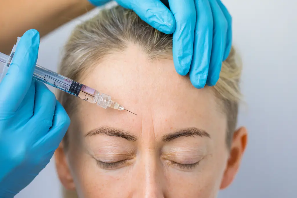 Forehead injection with botulinum toxin – basic course in aesthetic medicine
